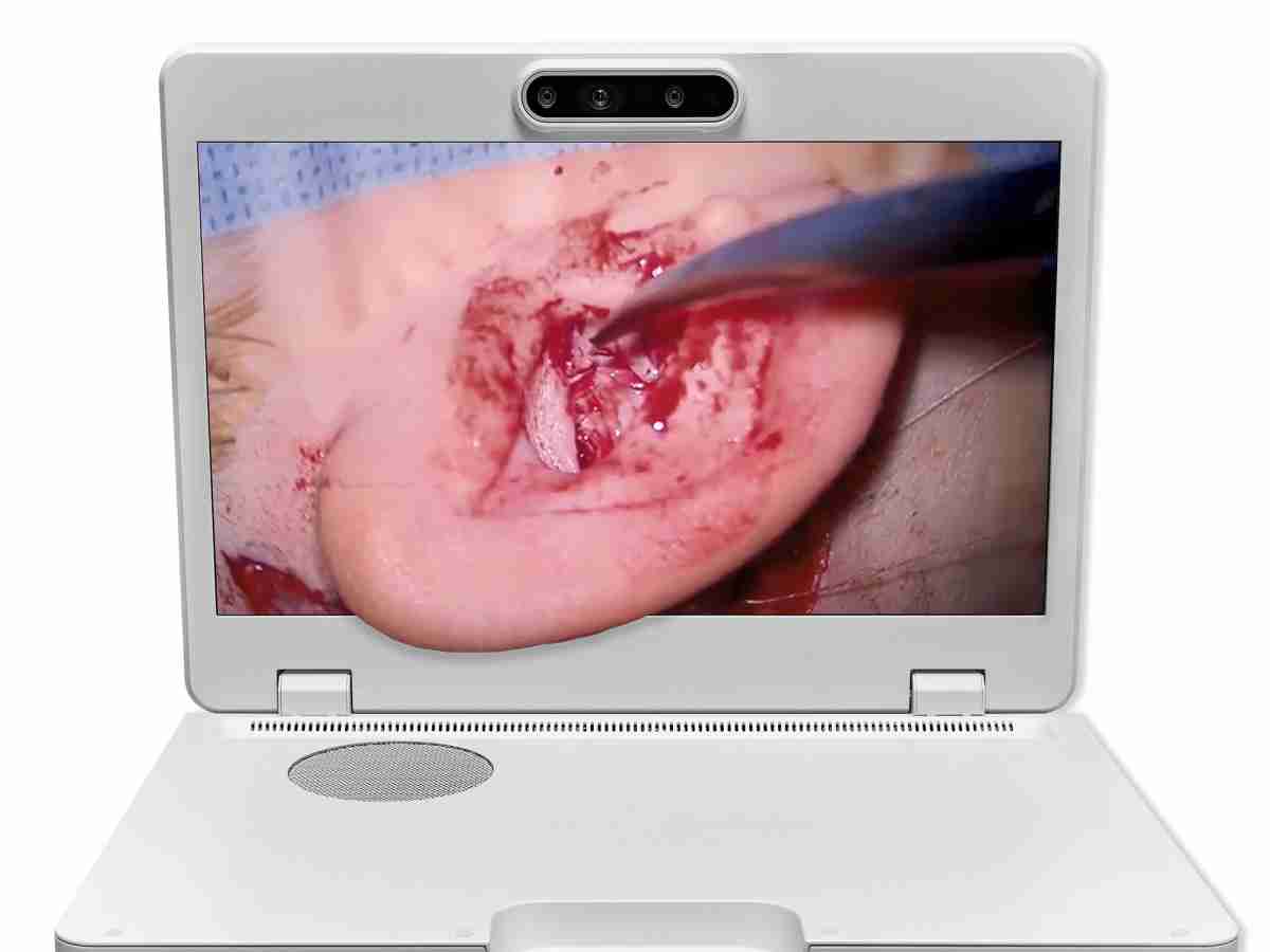 达擎之＂Heads-up 3D显微手术显示系统＂，，，整合4K裸眼3D显示及眼球追踪系统，，，具备快速追踪人眼移动位置功能，，减轻医师长时间维持固定姿势的负担，，，，让医师能有更宽广清晰的3D立体视野及更舒适的姿势来执行手术。。。。